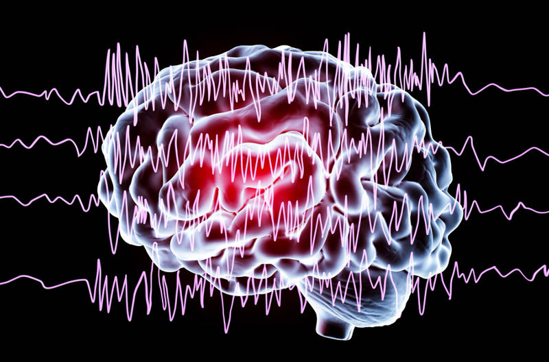 Seizure EKG overlaying picture of brain
